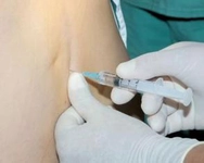 Beyin Omurilik Sıvısı Nasıl Alınır?